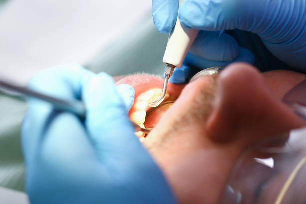 Best Tooth Pain Emergency Relief  in Bexley, OH