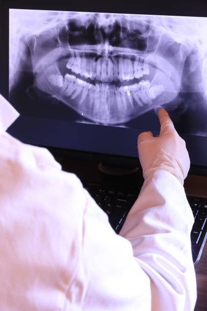 Best Dentist for Tooth Abscess  in Bexley, OH