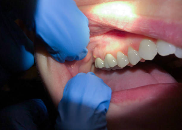 Best Knocked-Out Tooth Emergency  in Bexley, OH
